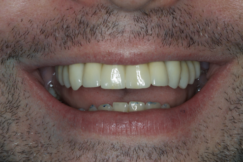 After image