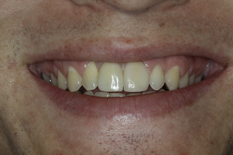 After image