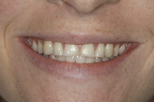 Before image