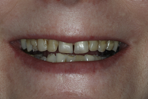 Before image