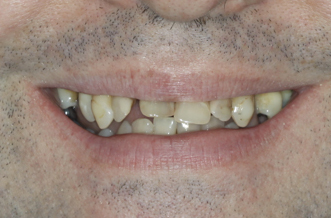 Before image
