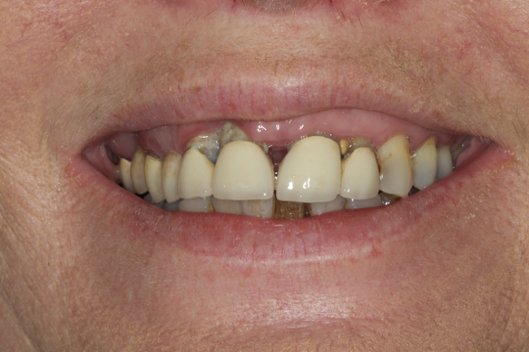 Before image